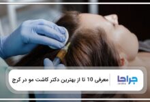 بهترین دکتر کاشت مو در کرج