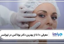 بهترین دکتر بوتاکس در تهرانسر