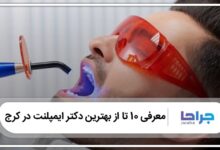 بهترین دکتر ایمپلنت در کرج