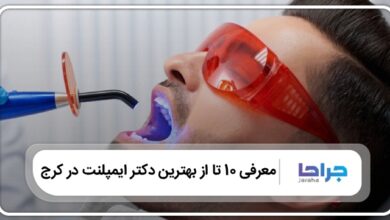 بهترین دکتر ایمپلنت در کرج