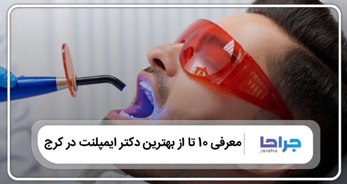 بهترین دکتر ایمپلنت در کرج
