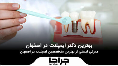 بهترین دکتر ایمپلنت در اصفهان