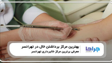 بهترین مرکز برداشتن خال در تهرانسر