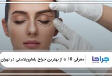 بهترین جراح بلفاروپلاستی در تهران