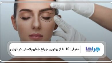 بهترین جراح بلفاروپلاستی در تهران