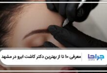 بهترین دکتر کاشت ابرو در مشهد