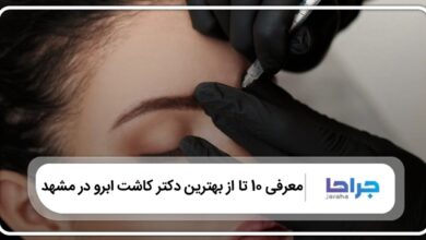 بهترین دکتر کاشت ابرو در مشهد