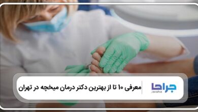 بهترین دکتر درمان میخچه در تهران