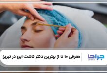 بهترین دکتر کاشت ابرو در تبریز