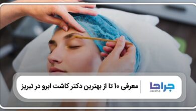 بهترین دکتر کاشت ابرو در تبریز