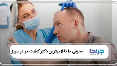بهترین دکتر کاشت مو در تبریز