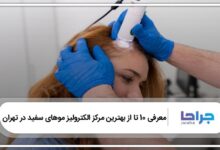 بهترین مرکز الکترولیز موهای سفید در تهران