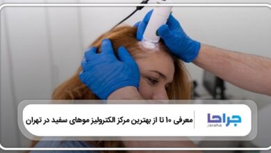 بهترین مرکز الکترولیز موهای سفید در تهران