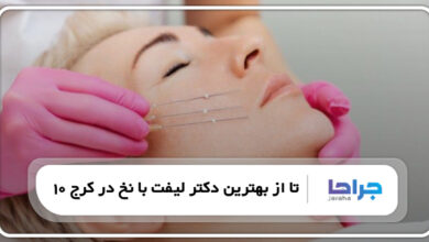 10 تا از بهترین دکتر لیفت با نخ در کرج
