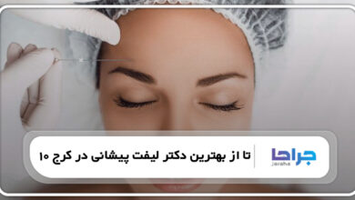 10 تا از بهترین دکتر لیفت پیشانی در کرج