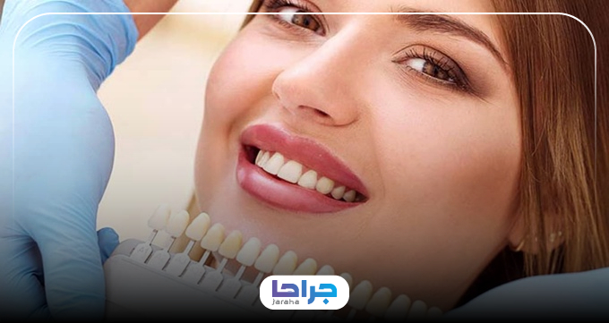 مزایای انجام کامپوزیت توسط بهترین متخصص کامپوزیت در اصفهان