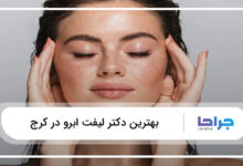 بهترین دکتر لیفت ابرو در کرج
