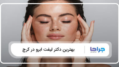 بهترین دکتر لیفت ابرو در کرج