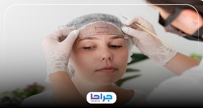 مزایای انجام لیفت ابرو نزد بهترین پزشکان لیفت ابرو در تهران