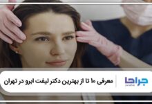 بهترین دکتر لیفت ابرو در تهران
