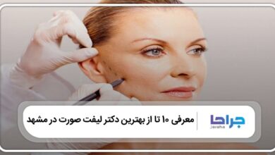 بهترین دکتر لیفت صورت در مشهد