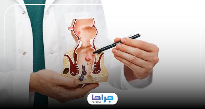 بهترین جراح فیستول چگونه از حادتر شدن فیستول پیشگیری میکند؟