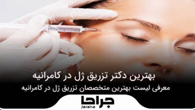بهترین دکتر تزریق ژل در کامرانیه