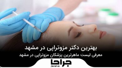 بهترین دکتر مزوتراپی در مشهد