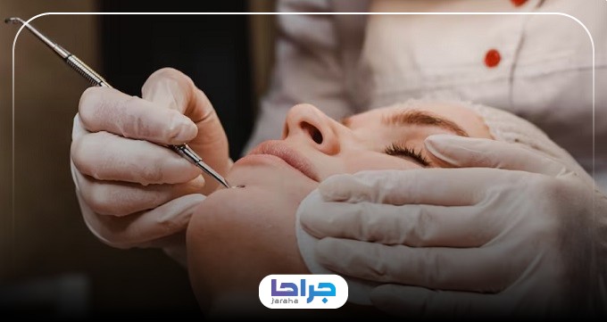 هزینه مراجعه به بهترین مرکز برداشتن خال در تهران چقدر است؟