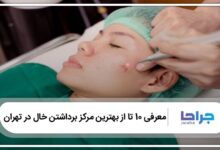 بهترین مرکز برداشتن خال در تهران