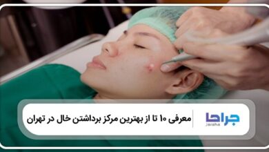 بهترین مرکز برداشتن خال در تهران