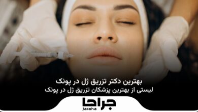 بهترین دکتر تزریق ژل در پونک