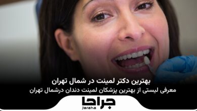 بهترین دکتر لمینت در شمال تهران