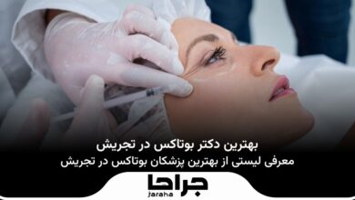 بهترین دکتر بوتاکس در تجریش