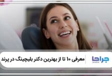 بهترین دکتر بلیچینگ در پرند