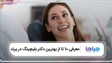 بهترین دکتر بلیچینگ در پرند