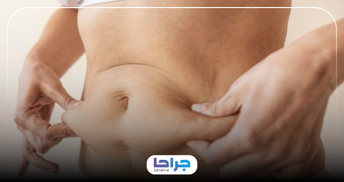 چطور بهترین جراح ابدومینوپلاستی را در کرج انتخاب کنیم؟