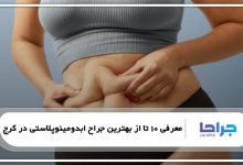 بهترین جراح ابدومینوپلاستی در کرج