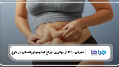 بهترین جراح ابدومینوپلاستی در کرج