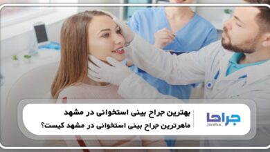 بهترین جراح بینی استخوانی در مشهد