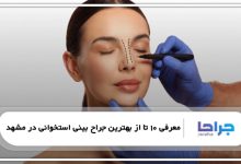 بهترین جراح بینی استخوانی در مشهد