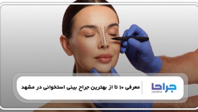 بهترین جراح بینی استخوانی در مشهد