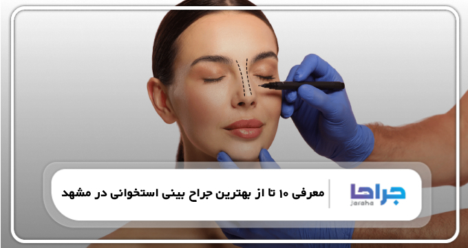 بهترین جراح بینی استخوانی در مشهد