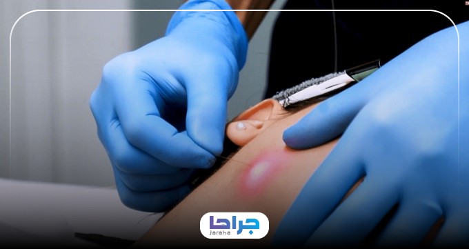 هزینه خدمات بهترین دکتر اندولیفت در اصفهان
