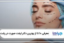 بهترین دکتر لیفت صورت در رشت