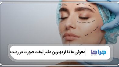 بهترین دکتر لیفت صورت در رشت