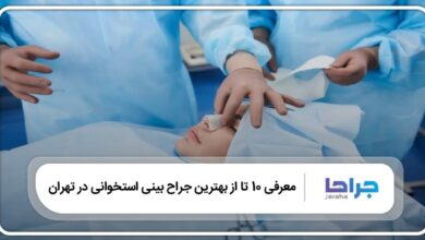 بهترین جراح بینی استخوانی در تهران
