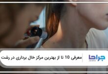 بهترین مرکز خال برداری در رشت