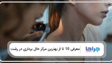 بهترین مرکز خال برداری در رشت