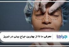 بهترین جراح بینی در تبریز
